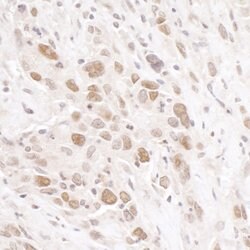 RIF1 Rabbit anti-Human, Polyclonal, Bethyl Laboratories 100 &mu;l; Unlabeled:Antibodies,