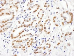 RING1 Rabbit anti-Human, Polyclonal, Bethyl Laboratories 100 &mu;L; Unconjugated:Antibodies,