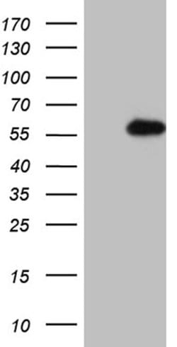 RING1 Mouse anti-Human, Clone: OTI2D11, lyophilized, TrueMAB 100 &mu;g;