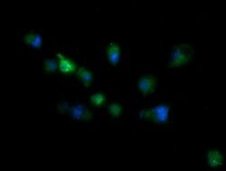 RIOK2 Mouse anti-Human, Mouse, Clone: OTI3E11, lyophilized, TrueMAB 100