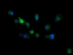 RIOK2 Mouse anti-Human, Mouse, Clone: OTI3E11, liquid, TrueMAB 100 &mu;L;