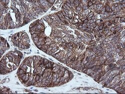 RIOK2 Mouse anti-Human, Mouse, Clone: OTI3E11, lyophilized, TrueMAB 100