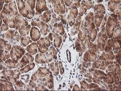 RIOK2 Mouse anti-Human, Mouse, Clone: OTI3E11, lyophilized, TrueMAB 100
