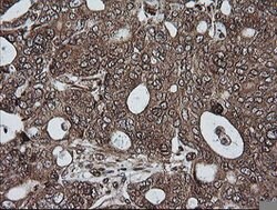 RIOK2 Mouse anti-Human, Mouse, Clone: OTI3E11, lyophilized, TrueMAB 100