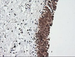 RIOK2 Mouse anti-Human, Mouse, Clone: OTI3E11, lyophilized, TrueMAB 100
