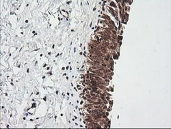 RIOK2 Mouse anti-Human, Mouse, Clone: OTI3E11, liquid, TrueMAB 100 &mu;L;