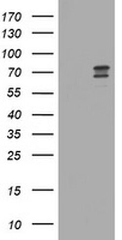 RIOK2 Monoclonal Antibody (OTI2F4), TrueMAB , OriGene 100 &mu;L; Unconjugated:Antibodies,