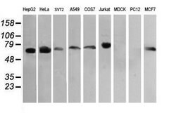 RIOK2 Mouse anti-Human, Mouse, Clone: OTI3E11, lyophilized, TrueMAB 100