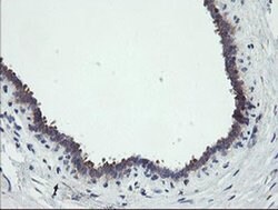 RIPK1 Mouse anti-Human, Clone: OTI2D6, liquid, TrueMAB 100 &mu;L; Unconjugated:Antibodies,