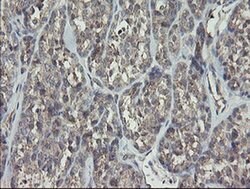 RIPK1 Mouse anti-Human, Clone: OTI2D6, liquid, TrueMAB 100 &mu;L; Unconjugated:Antibodies,