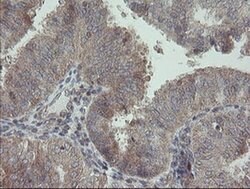 RIPK1 Mouse anti-Human, Clone: OTI2D6, liquid, TrueMAB 100 &mu;L; Unconjugated:Antibodies,