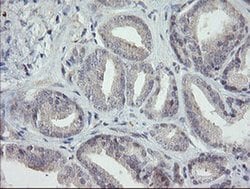 RIPK1 Mouse anti-Human, Clone: OTI2D6, liquid, TrueMAB 100 &mu;L; Unconjugated:Antibodies,