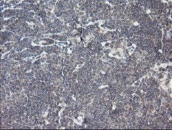RIPK1 Mouse anti-Human, Clone: OTI2D6, liquid, TrueMAB 100 &mu;L; Unconjugated:Antibodies,