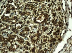 RIPK1 Mouse anti-Canine, Human, Clone: OTI2G3, liquid, TrueMAB 100 &mu;L;
