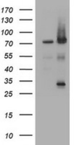 RIPK1 Mouse anti-Human, Clone: OTI2F1, lyophilized, TrueMAB 100 &mu;g;