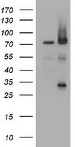 RIPK1 Monoclonal Antibody (OTI2F1), TrueMAB , OriGene 100 &mu;L; Unconjugated:Antibodies,