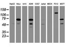 RIPK1 Mouse anti-Human, Clone: OTI2F1, lyophilized, TrueMAB 100 &mu;g;
