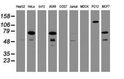 RIPK1 Monoclonal Antibody (OTI2F1), TrueMAB , OriGene 100 &mu;L; Unconjugated:Antibodies,
