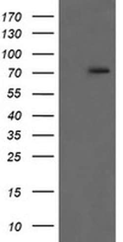 RIPK1 Monoclonal Antibody (OTI2F4), TrueMAB , OriGene:Antibodies:Primary
