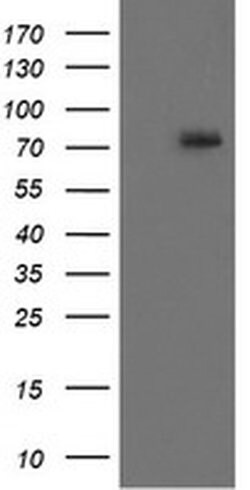 RIPK1 Mouse anti-Human, Clone: OTI2D6, liquid, TrueMAB 100 &mu;L; Unconjugated:Antibodies,