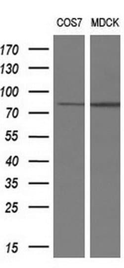 RIPK1 Mouse anti-Human, Clone: OTI2D6, liquid, TrueMAB 100 &mu;L; Unconjugated:Antibodies,