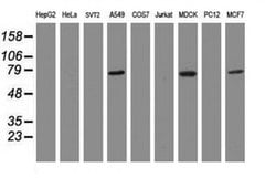 RIPK1 Mouse anti-Canine, Human, Clone: OTI2G3, liquid, TrueMAB 100 &mu;L;