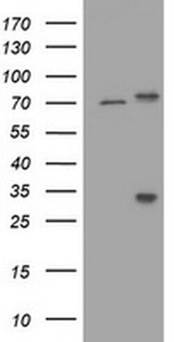 RIPK1 Monoclonal Antibody (OTI1A7), TrueMAB , OriGene:Antibodies:Primary
