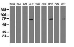 RIPK1 Mouse anti-Canine, Human, Clone: OTI1A7, lyophilized, TrueMAB 100