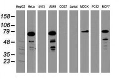 RIPK1 Monoclonal Antibody (OTI2A8), TrueMAB , OriGene 100 &mu;L; Unconjugated:Antibodies,