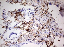 RIPK3 Mouse anti-Human, Clone: OTI2B10, lyophilized, TrueMAB 100 &mu;g;