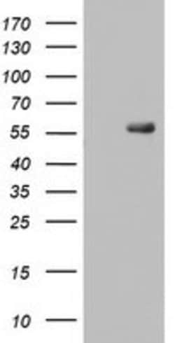 RIPK3 Mouse anti-Human, Clone: OTI2B10, lyophilized, TrueMAB 100 &mu;g;