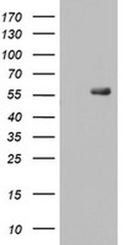 RIPK3 Mouse anti-Human, Clone: OTI2B10, liquid, TrueMAB 100 &mu;L; Unconjugated:Antibodies,