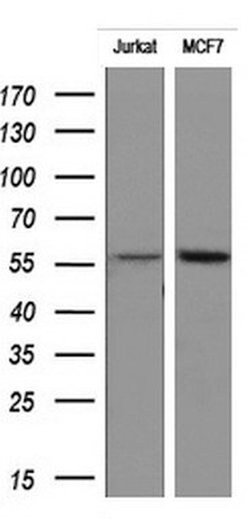 RIPK3 Mouse anti-Human, Clone: OTI2B10, lyophilized, TrueMAB 100 &mu;g;