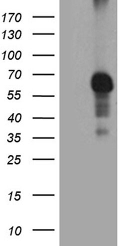 RIPK3 Monoclonal Antibody (OTI1D8), TrueMAB , OriGene 100 &mu;L; Unconjugated:Antibodies,