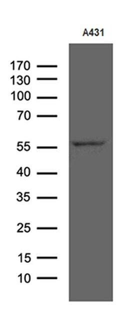 RIPK3 Monoclonal Antibody (OTI1D8), TrueMAB , OriGene 100 &mu;L; Unconjugated:Antibodies,