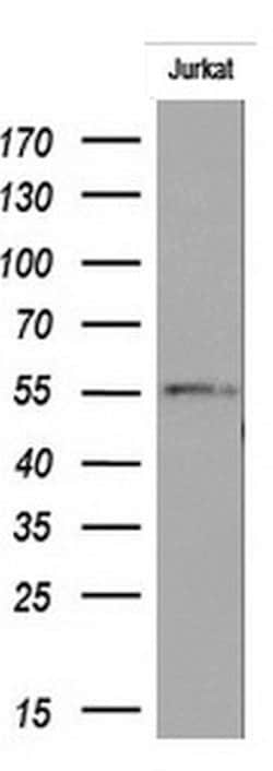 RIPK3 Monoclonal Antibody (OTI2F11), TrueMAB , OriGene 100 &mu;L; Unconjugated:Antibodies,