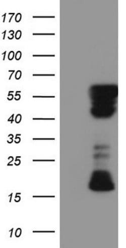 RIPK3 Mouse anti-Human, Clone: OTI2C11, lyophilized, TrueMAB 100 &mu;g;