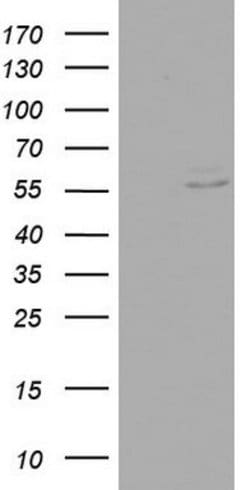 RIPK3 Mouse anti-Human, Clone: OTI3A12, lyophilized, TrueMAB 100 &mu;g;