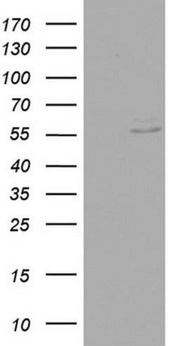 RIPK3 Monoclonal Antibody (OTI3A12), TrueMAB , OriGene 30 &mu;L; Unconjugated:Antibodies,
