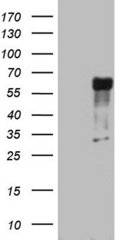 RIPK3 Mouse anti-Human, Clone: OTI1H1, lyophilized, TrueMAB 100 &mu;g;