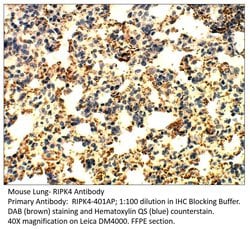 RIPK4 Rabbit anti-Human, Mouse, Rat, Polyclonal, FabGennix 200 &mu;L; Unconjugated:Antibodies,