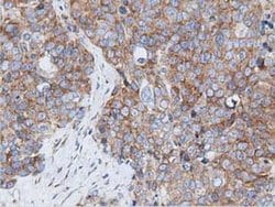 RIT2 Monoclonal Antibody (OTI3F4), TrueMAB , OriGene 30 &mu;L; Unconjugated:Antibodies,