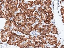 RIT2 Monoclonal Antibody (OTI3F4), TrueMAB , OriGene 30 &mu;L; Unconjugated:Antibodies,