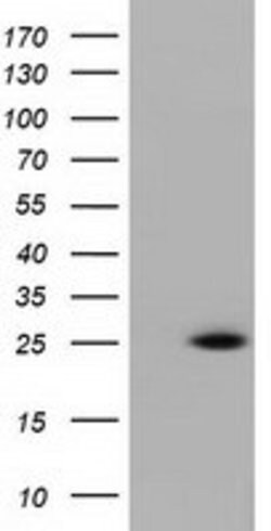 RIT2 Mouse anti-Human, Clone: OTI1G2, lyophilized, TrueMAB 100 &mu;g; Unconjugated:Antibodies,