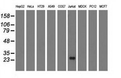 RIT2 Monoclonal Antibody (OTI4B5), TrueMAB , OriGene 30 &mu;L; Unconjugated:Antibodies,