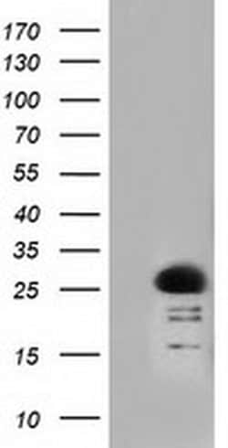 RIT2 Monoclonal Antibody (OTI3F4), TrueMAB , OriGene 30 &mu;L; Unconjugated:Antibodies,
