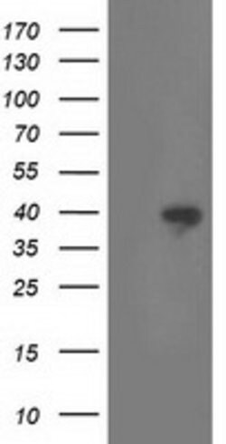 RLBP1 Mouse anti-Human, Clone: OTI1B4, lyophilized, TrueMAB 100 &mu;g;