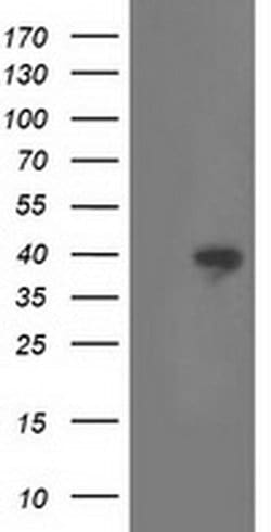 RLBP1 Monoclonal Antibody (OTI1B4), TrueMAB , OriGene 30 &mu;L; Unconjugated:Antibodies,