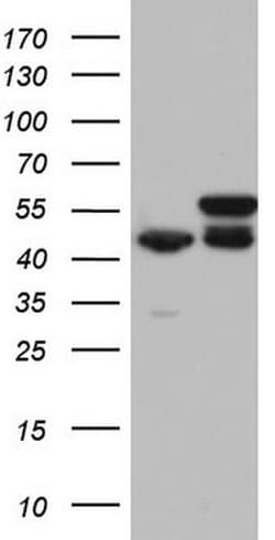 RMND5A Monoclonal Antibody (OTI2C6), TrueMAB , OriGene 30 &mu;L; Unconjugated:Antibodies,