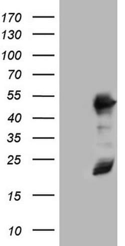 RMND5A Monoclonal Antibody (OTI1B7), TrueMAB , OriGene 100 &mu;L; Unconjugated:Antibodies,